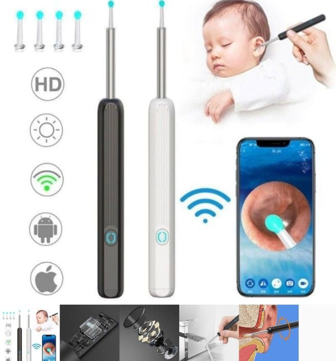 Ear wax remover with HD camera Wi-Fi connection