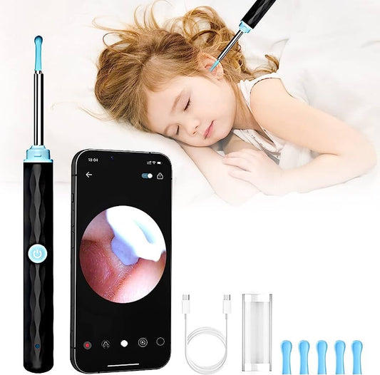 Ear wax remover with HD camera Wi-Fi connection